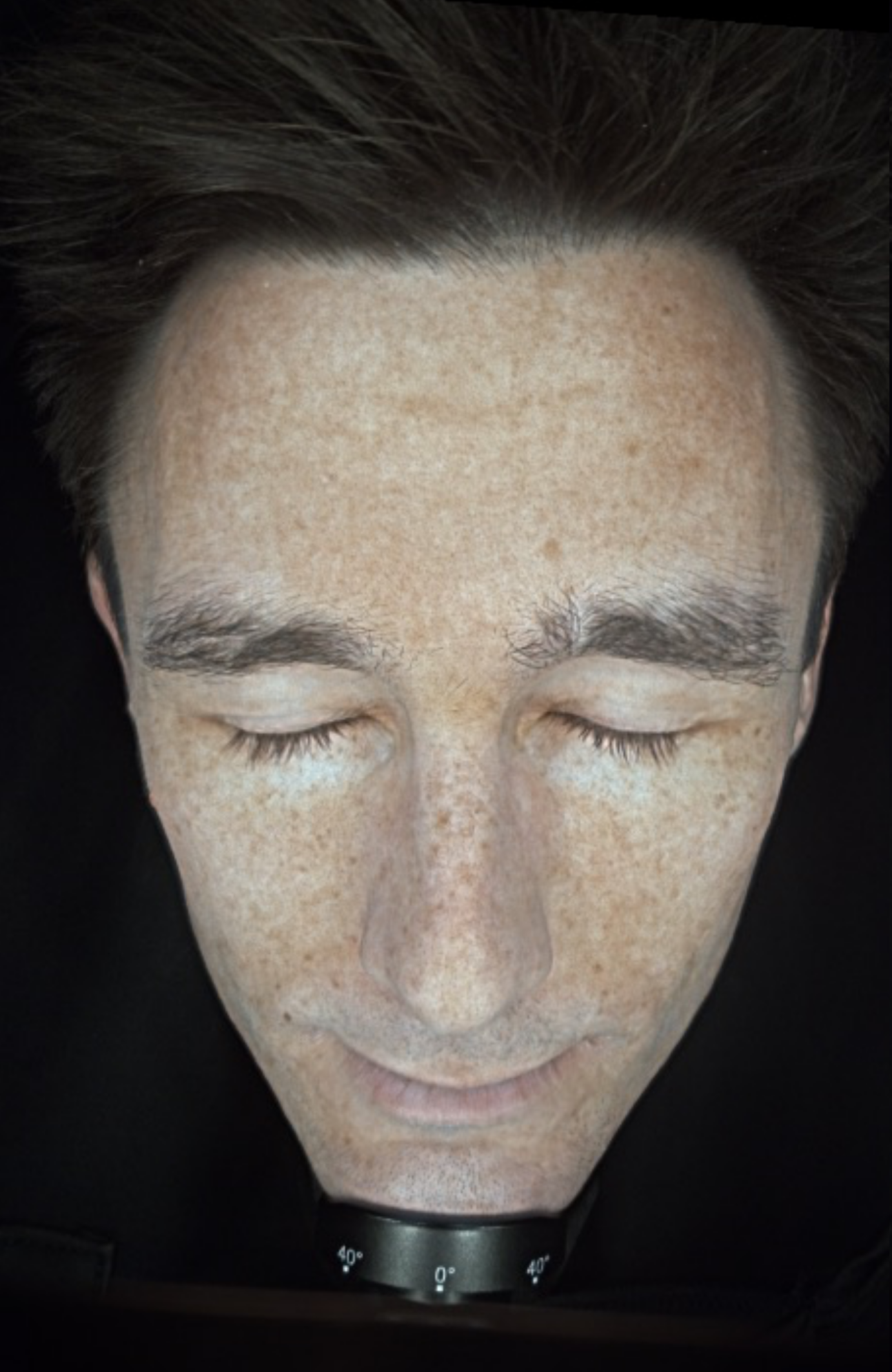 Clinical skin texture scan showing the softening of fine lines and a smoother, more resilient skin surface after 6 weeks of cellular nutrition - AFTER IMAGE